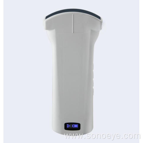 Portable Convex Mini Ultrasound Scanner